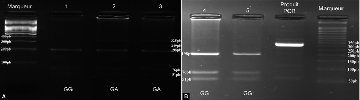 Figs 1A and B