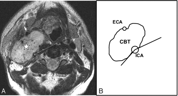 Fig 4.