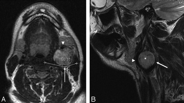 Fig 3.