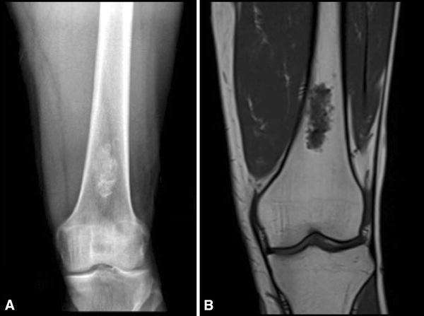 Fig. 1A–B