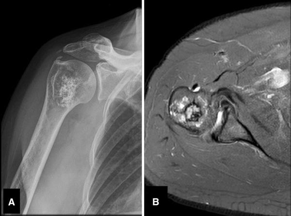 Fig. 3A–B