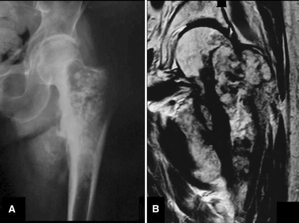 Fig. 2A–B