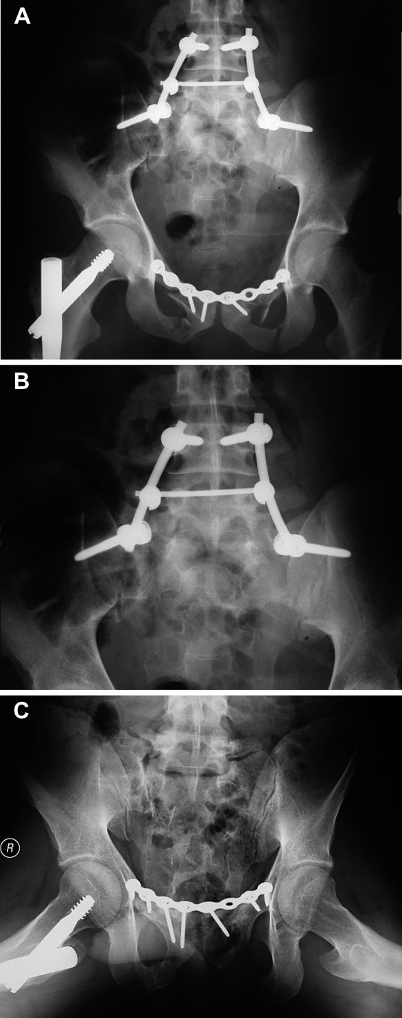 Fig. 3A-C