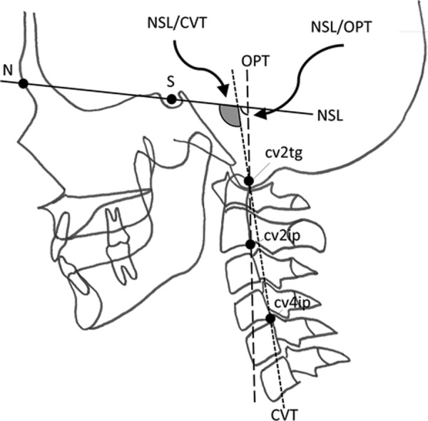 Fig. 2.