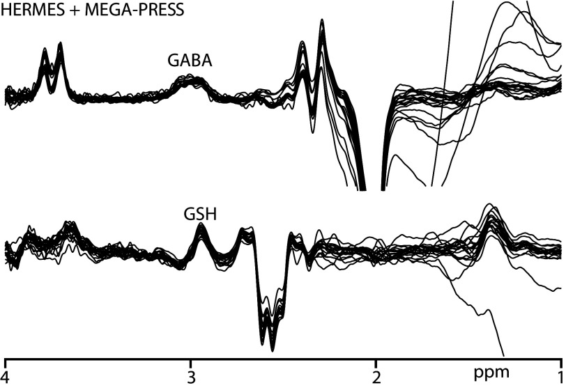 Fig 2.