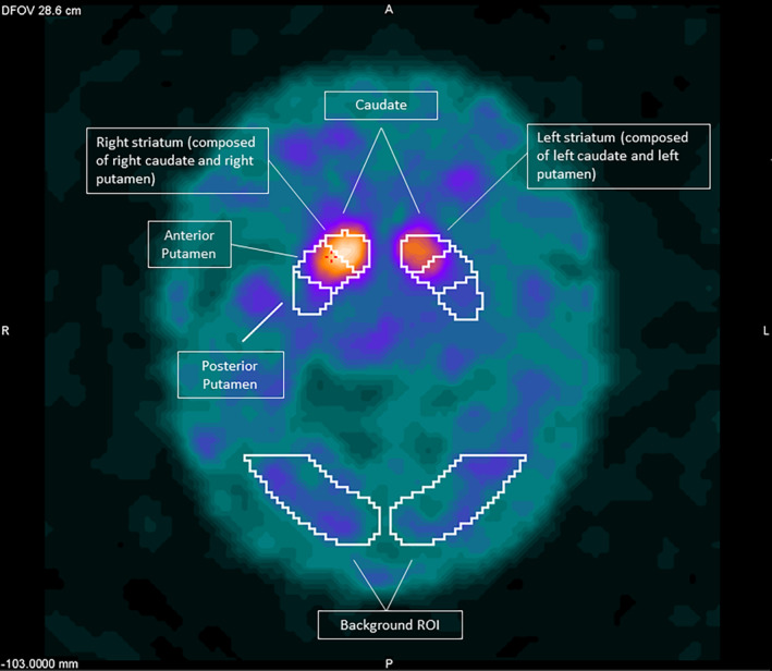 FIG. 1