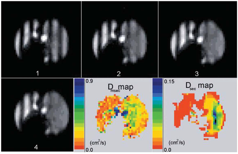 FIG. 15.