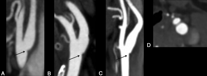 Fig 2.