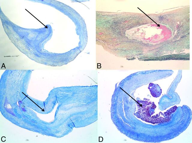 Fig 3.