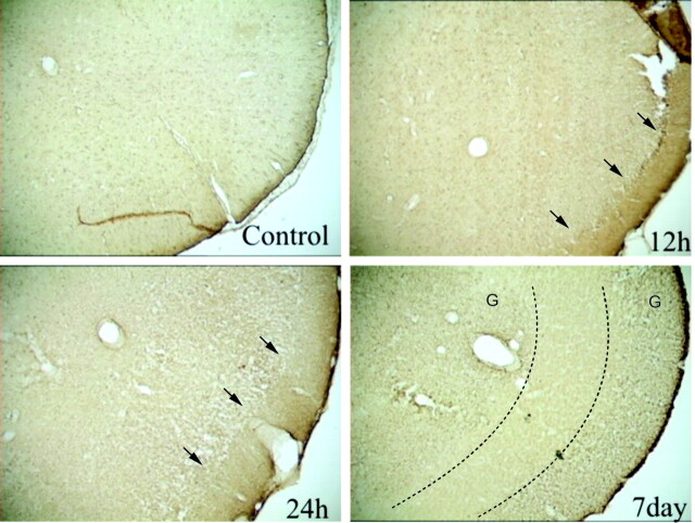 Fig 6.