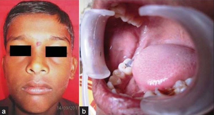 Figure 3(a,b)