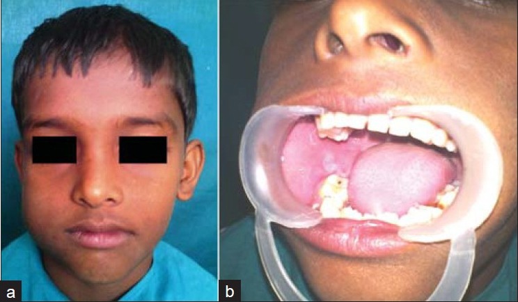 Figure 1(a,b)