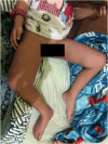 Fig 1