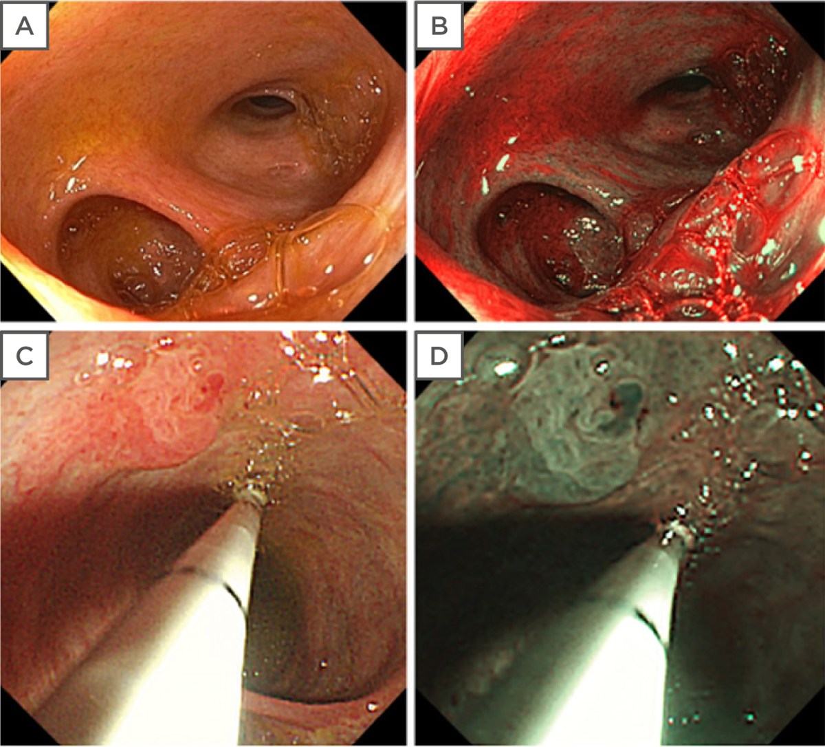 Figure 1: