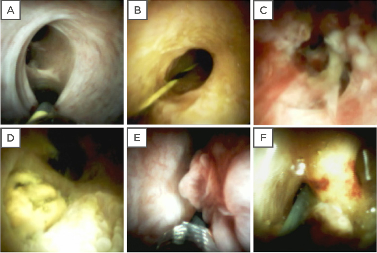 Figure 2: