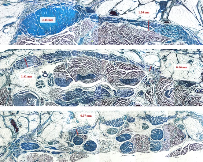 Fig. 3