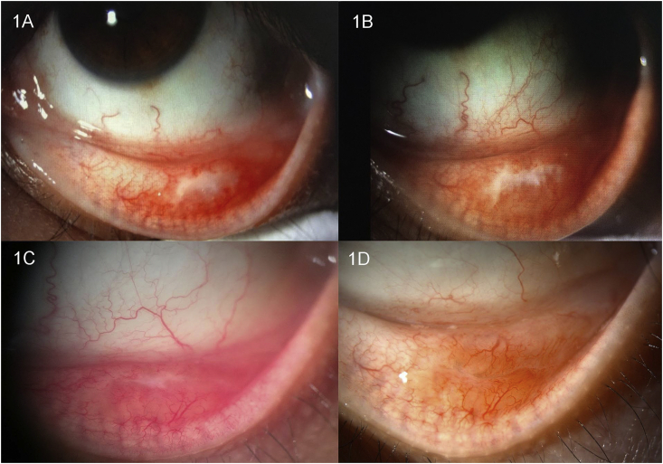 Fig. 1