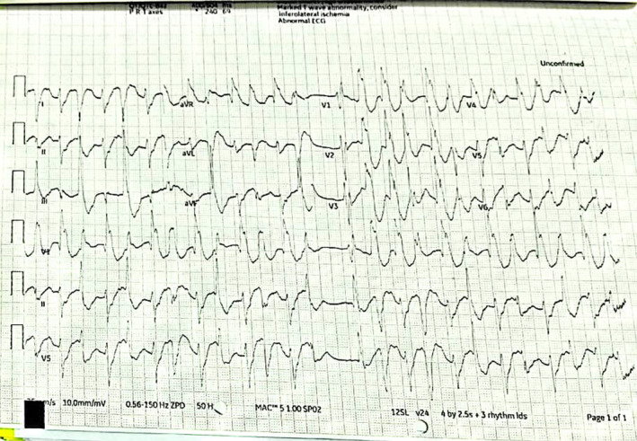 Accidental poisoning with aconite overdose: A case report and ...