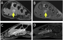 Fig. 12