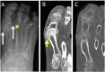 Fig. 11