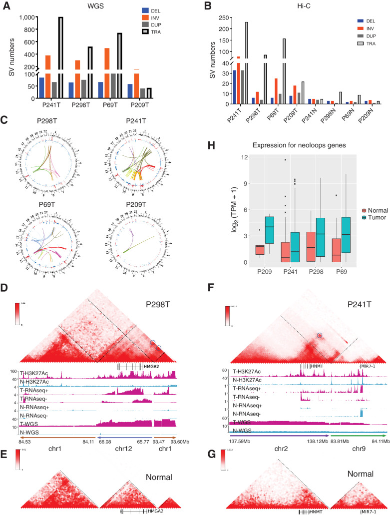 Figure 4. Enhancer hijacking events contribute to the oncogene mis-regulation in liposarcoma patient samples. A, B, The stratified number of SVs identified from WGS (A) and Hi-C (B). C, The circos plot showing SVs and CNVs identified in P241, P298, P69, P209 patient samples detected from both Hi-C and WGS data. D, E, The reconstructed Hi-C map and genomic ChIP-seq, RNA-seq, and WGS tracks for translocation events chr1:84.11Mb-84.53Mb, chr12:65.77Mb-66.08Mb, and chr1:93.47–93.60Mb (D) from P298T and the Hi-C map interactions from the same regions in merged normal samples. F, G, The reconstructed Hi-C map and genomic ChIP-seq, RNA-seq, and WGS tracks for translocation events chr2:137.59Mb-138.12Mb, chr9:83.81Mb-84.11Mb (F) from P241T and the Hi-C map interactions from the same regions in merged normal samples (G). H, Boxplot for expression levels of genes located within neo-loops anchor regions in patient samples.