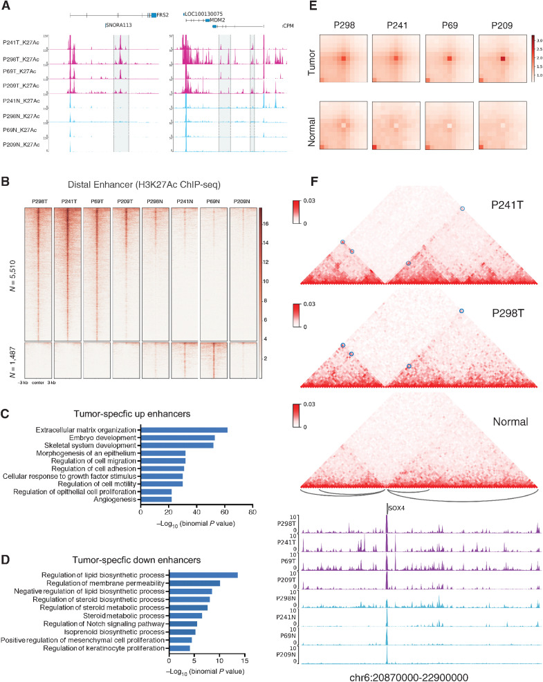 Figure 2. Enhancer and chromatin interaction landscape in Liposarcoma patient samples. A, Example regions around chr12: 69,445,000–69,585,000 and chr12: 68,800,000–68,965,000 corresponding to genes FRS2 and MDM2 of tumor-specific enhancers. B, Heatmap of genome wide tumor-specific distal enhancers at CNV free regions. C and D, The GREAT analysis for the pathway enrichment of the tumor-specific enhancers. E, APA for cancer-specific chromatin interactions in P298, P241, P69, and P209 tumor and normal samples (n = 1,823). F, Cancer-specific chromatin interactions involving SOX4 genomic region. The blue circles on the Hi-C map highlights the positions of the cancer-specific interactions as well as the arcs below the Hi-C maps. The top two panels of the Hi-C maps are from the P241, and P298 patient tumor samples and the bottom panel shows the merged Hi-C matrix from all the normal tissue samples. The tracks below are the H3K27Ac ChIP-seq profiles for the patient samples from both tumor (purple) and normal (blue) tissues.