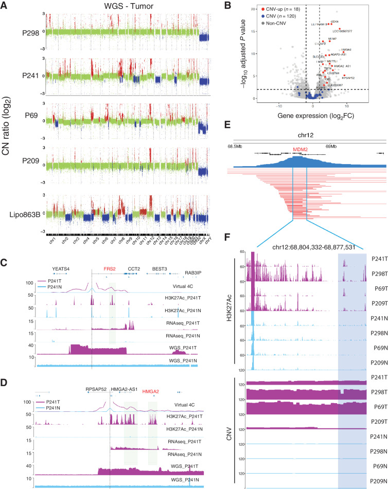 Figure 3. The identification of the enhancer coamplification events. A, The CNV profiles for Lipo863B, P298, P241, P69, and P209 identified from the WGS data. B, Volcano plot for the four pairs of patient samples. (Red: copy-number gained genes with significant differential expression, blue: copy-number gained genes with no significant differential expression.) C, D, Examples of enhancer coamplification for FRS2 (chr12:69,300,000–69,800,000) and HMGA2 (chr12:65,600,000–66,100,000) gene in P241. Gene TSS is marked with a dash line. The co-amplified enhancer is highlighted in sierra blue rectangles. E, The CNV segments for the TCGA liposarcoma patient samples covering the MDM2 gene. F, The H3K27Ac ChIP-seq track and CNV profiles for P298, P241, P69, and P209 samples at the recurrent CNV regions from TCGA.