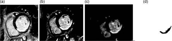 Fig. 11