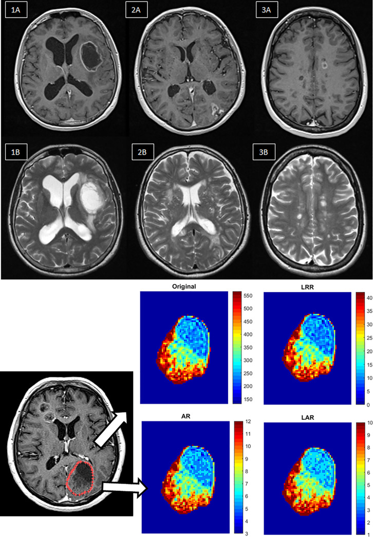 Fig 1