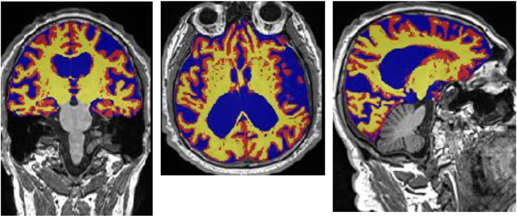 Fig. 1