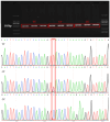 Gel electrophoresis and DNA sequencing results. The top shows bands labeled TT, CT, CC alongside a 505 bp marker. The bottom displays three chromatograms for TT, CT, and CC genotypes with highlighted nucleotide positions.