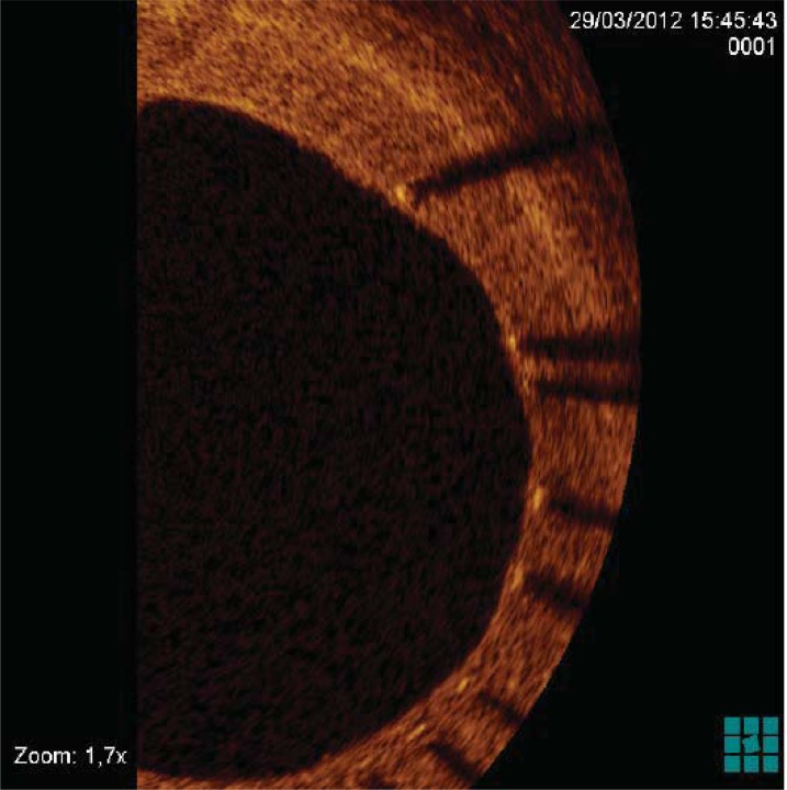 Fig. (4)