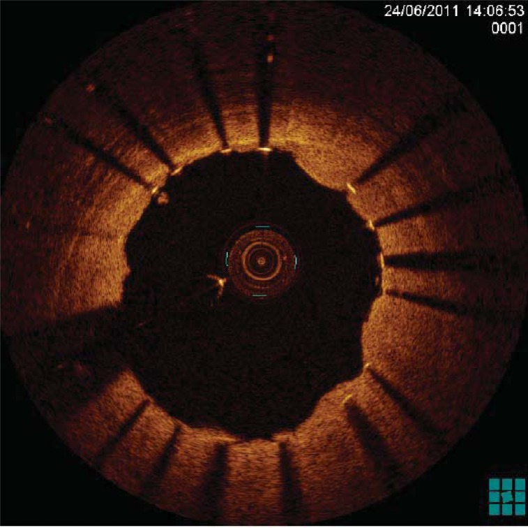 Fig. (3)