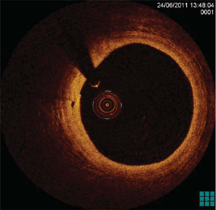 Fig. (1)