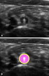 Fig. 3