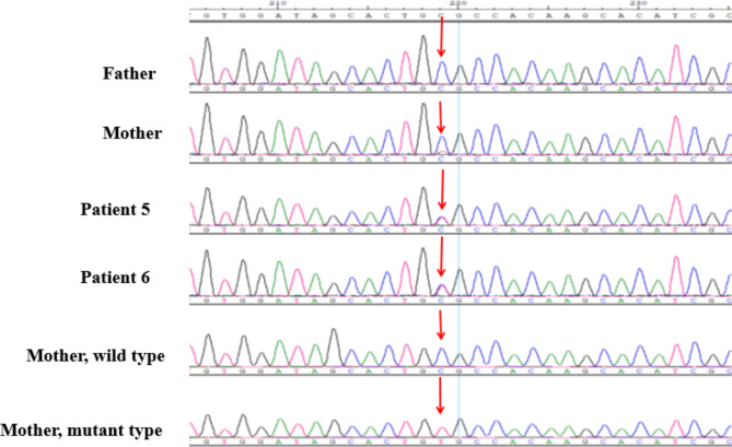 Fig. 2B