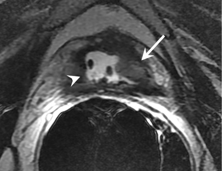 Figure 19a: