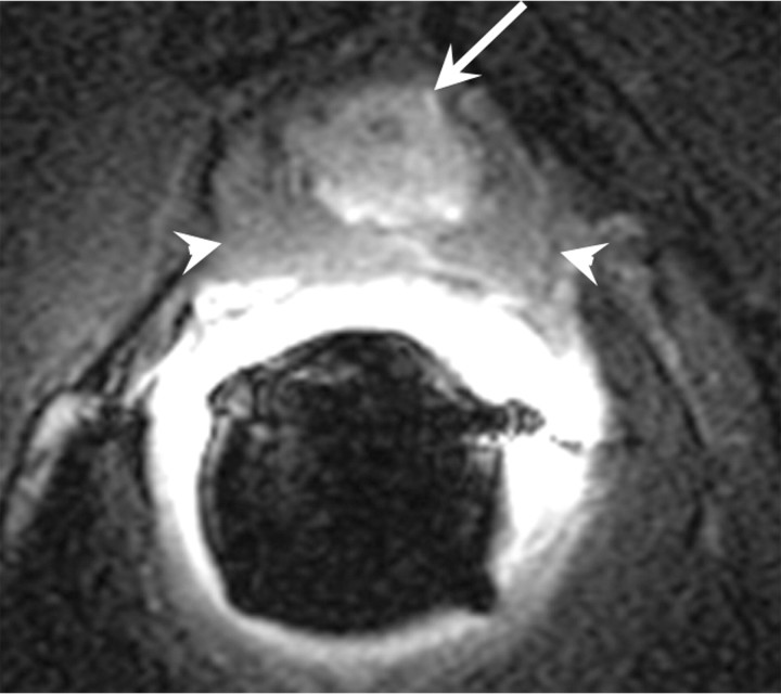 Figure 18b: