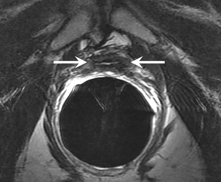 Figure 1a: