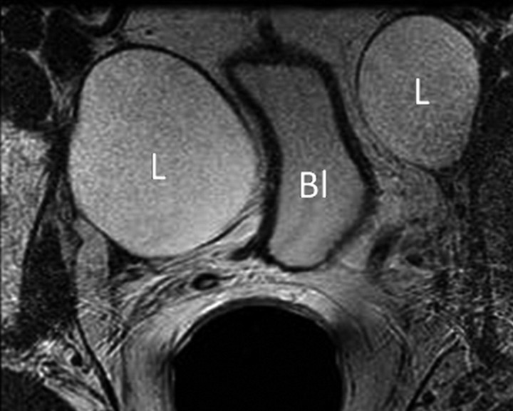 Figure 3a: