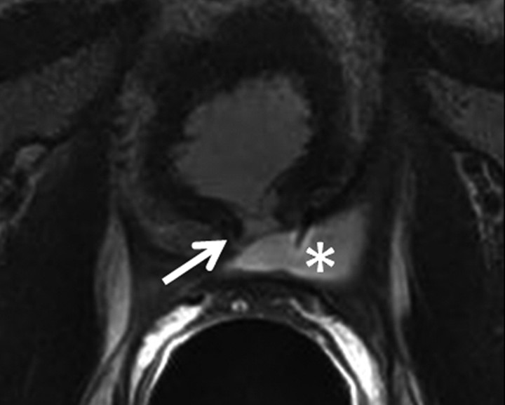 Figure 3b: