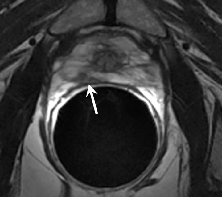 Figure 9a: