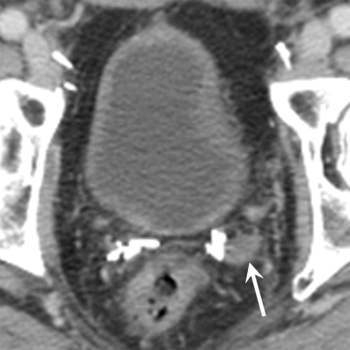 Figure 2a: