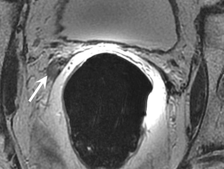 Figure 5a: