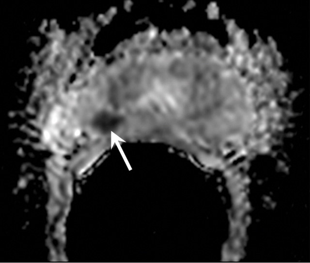 Figure 12b: