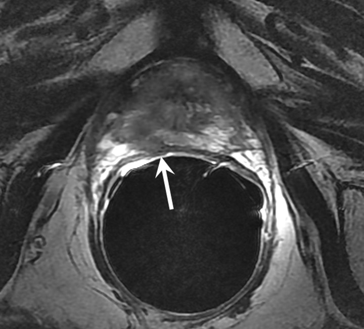 Figure 9b: