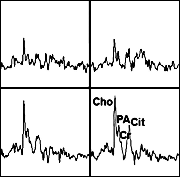 Figure 14b: