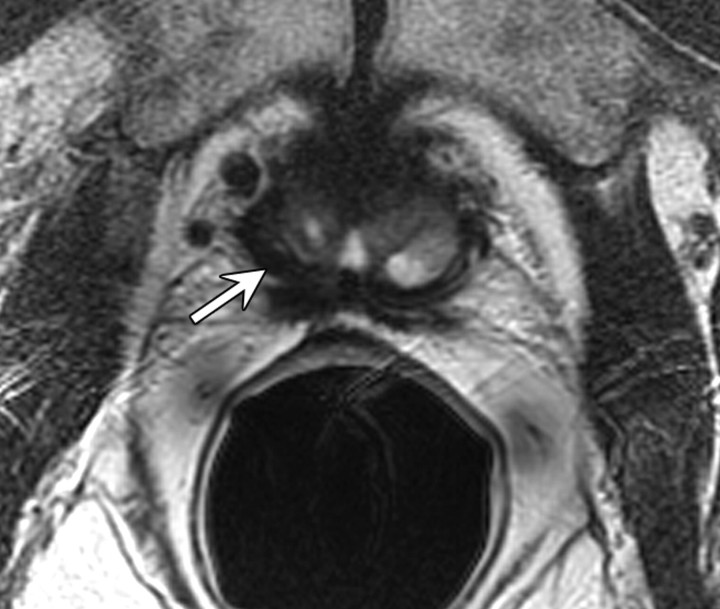 Figure 17a: