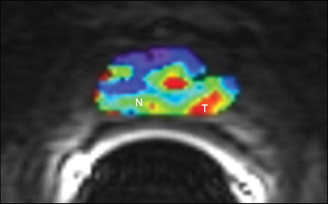 Figure 11b: