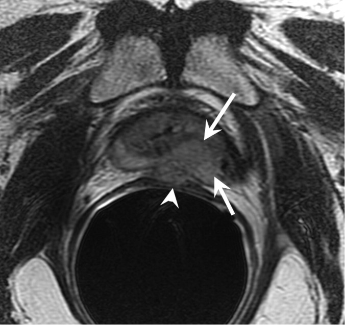 Figure 15a: